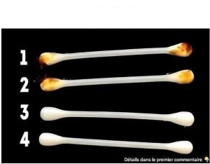 Nasze uszy ujawniają prawdziwy stan naszego zdrowia