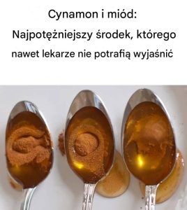 Cynamon i miód: potężny naturalny środek, który wciąż zadziwia współczesną medycynę