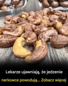 Lekarze ujawniają, że jedzenie orzechów nerkowca powoduje.