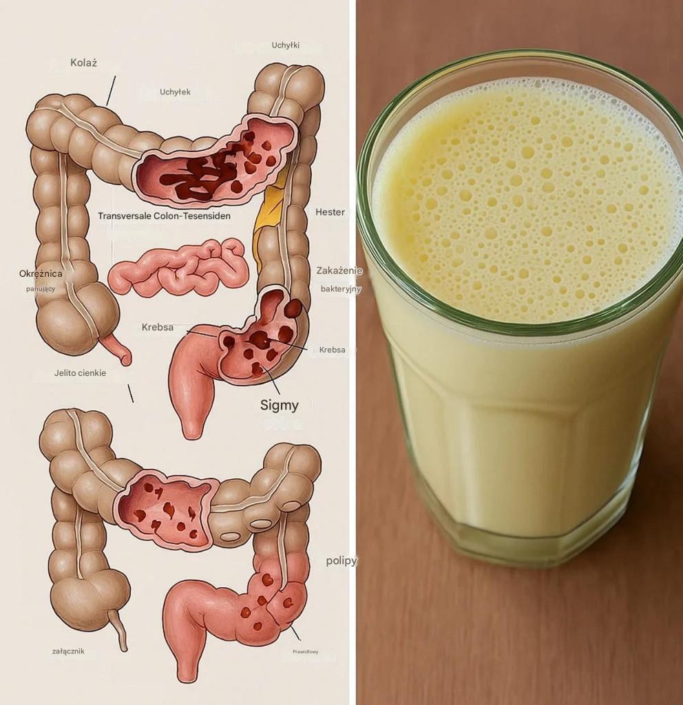 Le jus naturel qui vide les intestins et excréte des kilos de toxines et de matières fécales.