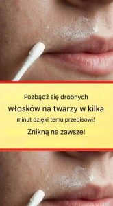 Ten naturalny przepis trwale usunie włosy z twarzyTen naturalny przepis trwale usunie włosy z twarzy