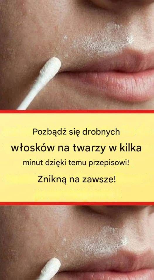 Ten naturalny przepis trwale usunie włosy z twarzyTen naturalny przepis trwale usunie włosy z twarzy
