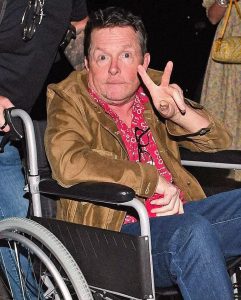 Stał się bardzo młodą międzynarodową gwiazdą, ale skończyło się na poważnej i nieuleczalnej chorobie. Zgadnij, kto jest na zdjęciu!