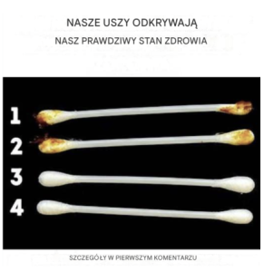 Nasze uszy ujawniają prawdziwy stan naszego zdrowia