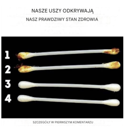 Nasze uszy ujawniają prawdziwy stan naszego zdrowia