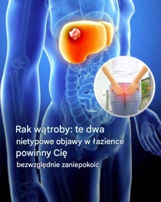 Rak choroby: choroba, która jest zakażona śmiercią Thierry'ego Ardissona