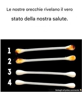 Il corpo umano non smette mai di stupirci con il suo funzionamento. È infatti in grado di inviarci segnali per avvisarci di una condizione o di un problema attraverso i vari organi e le aree che lo compongono. Inoltre, sapevate che le nostre orecchie possono rivelarci molto sulla nostra salute?