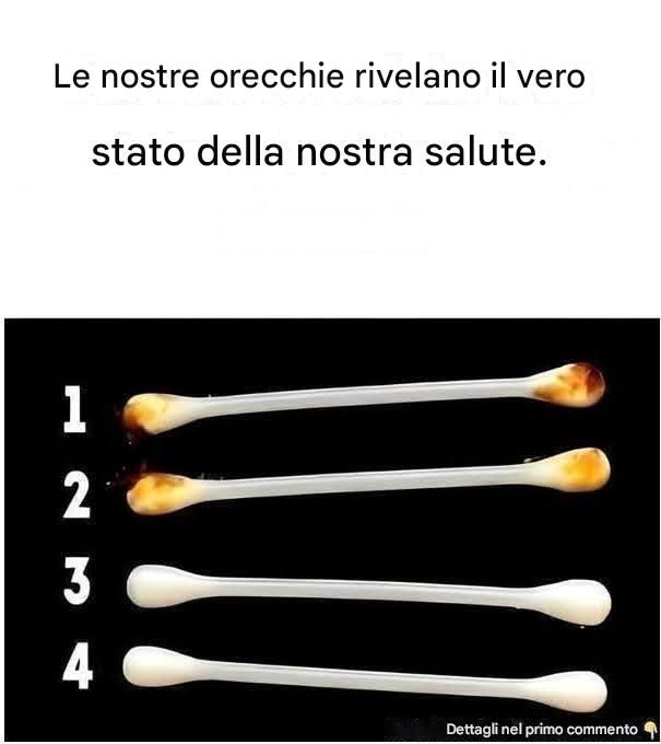Il corpo umano non smette mai di stupirci con il suo funzionamento. È infatti in grado di inviarci segnali per avvisarci di una condizione o di un problema attraverso i vari organi e le aree che lo compongono. Inoltre, sapevate che le nostre orecchie possono rivelarci molto sulla nostra salute?