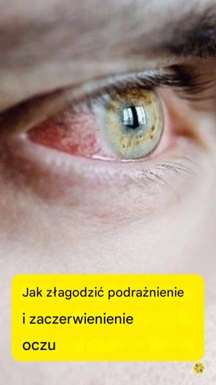 Jedzenie, które w mgnieniu oka leczy Twoje podrażnione oczy!