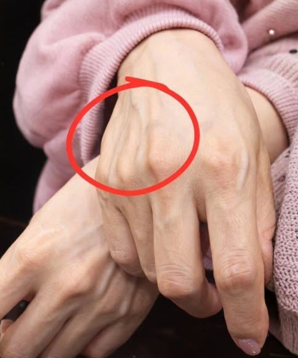 Se hai vene visibili, significa che sei...? Controlla il primo commento 👇