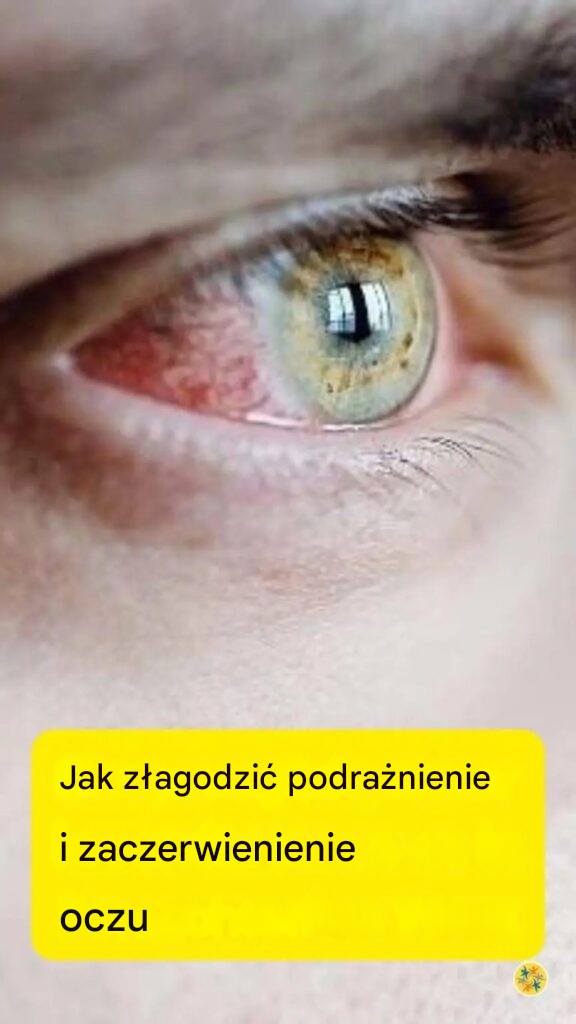 Jedzenie, które w mgnieniu oka leczy Twoje podrażnione oczy!