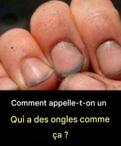 Jak nazwać osobę, która ma takie paznokcie?