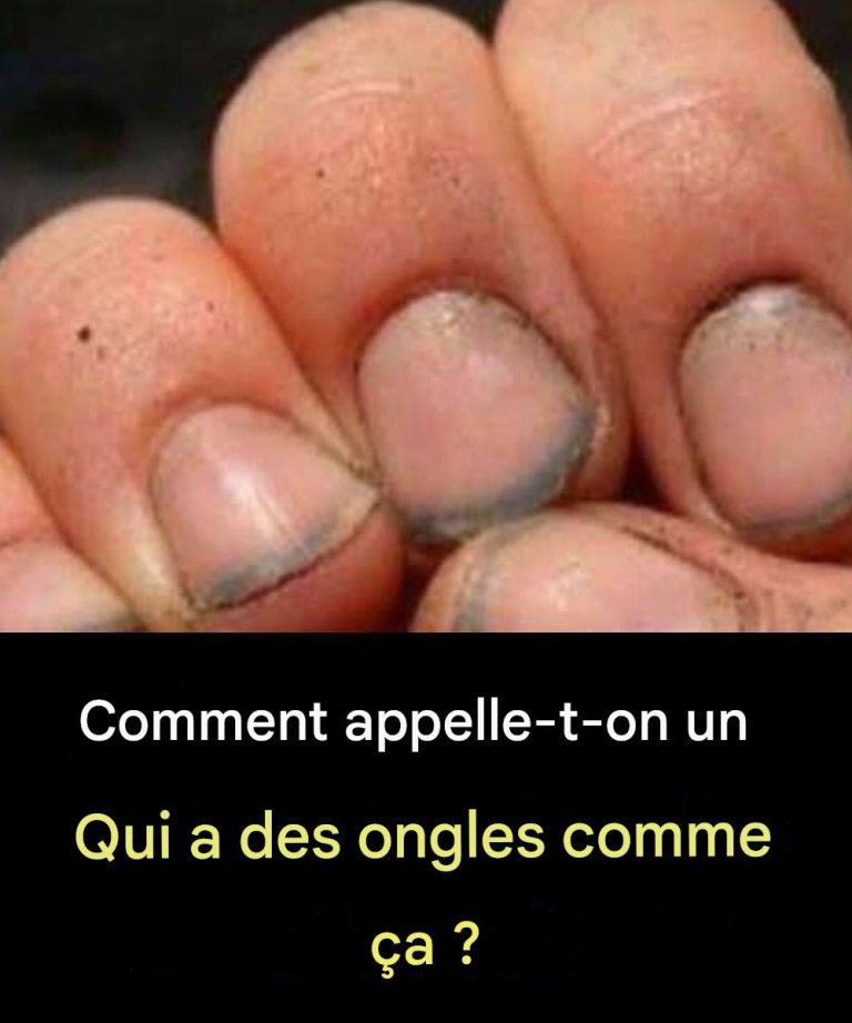 Jak nazwać osobę, która ma takie paznokcie?