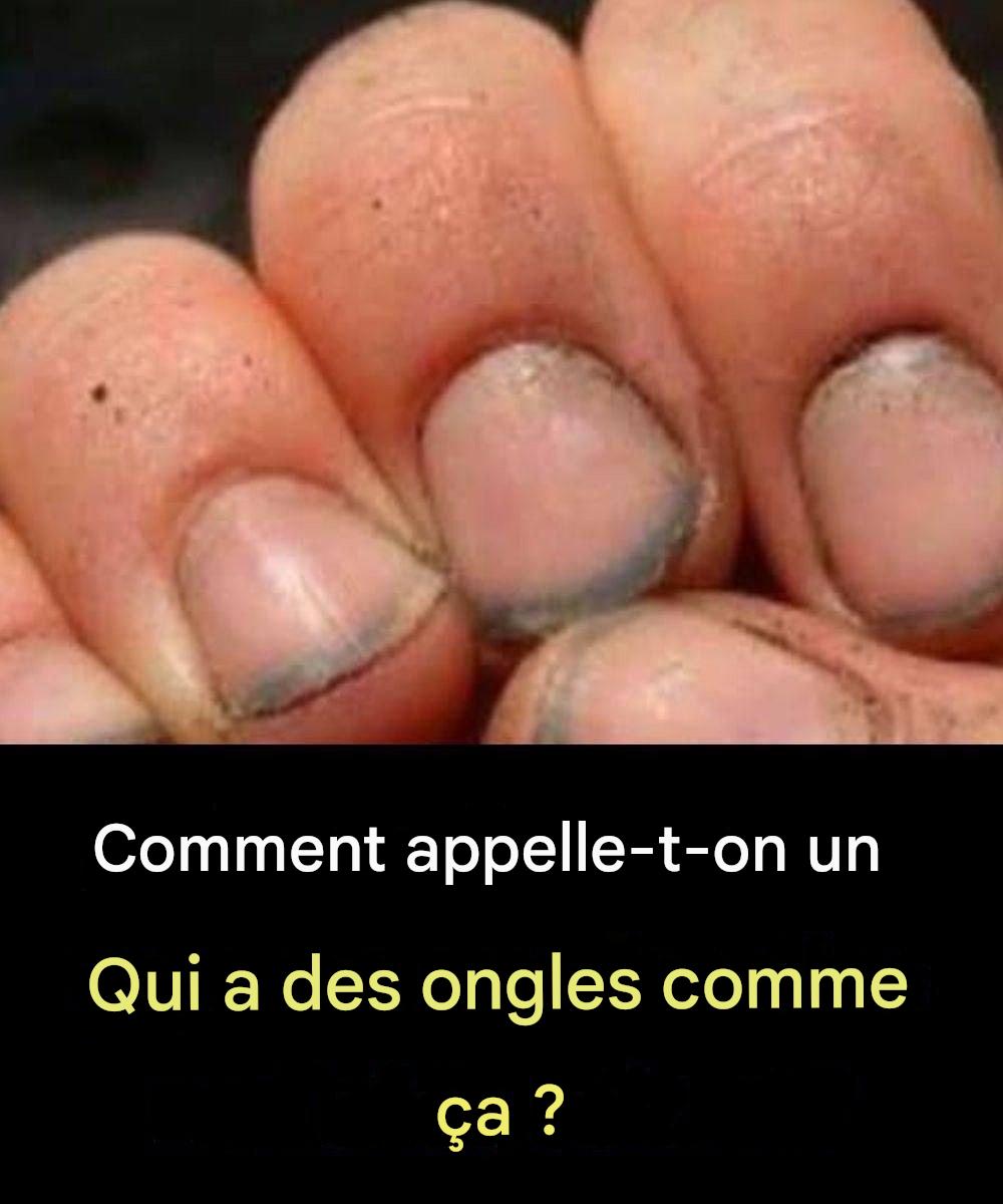 Jak nazwać osobę, która ma takie paznokcie?
