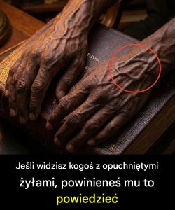 6 zmian w ciele, które mogą sprawić, że żyły będą bardziej widoczne