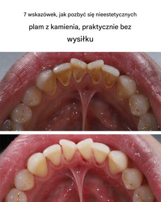 7 wskazówek, jak pozbyć się nieestetycznych plam z kamienia, praktycznie bez wysiłku