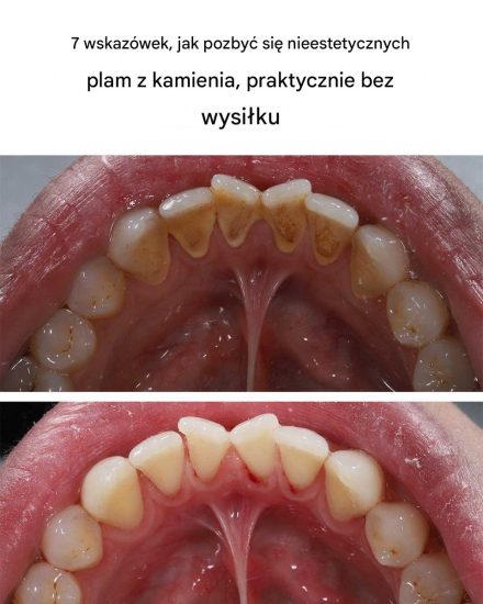 7 wskazówek, jak pozbyć się nieestetycznych plam z kamienia, praktycznie bez wysiłku