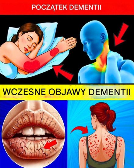 10 wczesnych objawów demencji, których NIGDY nie należy ignorować!