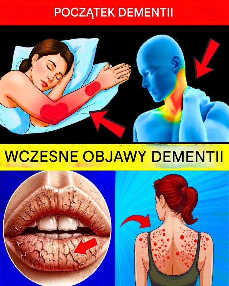 10 wczesnych objawów demencji, których NIGDY nie należy ignorować!
