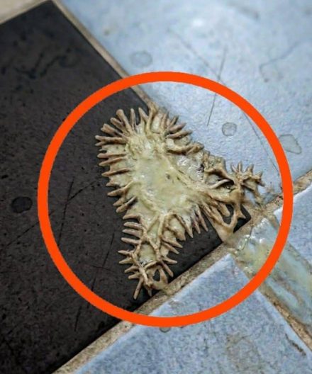 wSkutki uboczne atorwastatyny: Musisz wiedzieć o typowych reakcjach, które sobie z nimi radzą