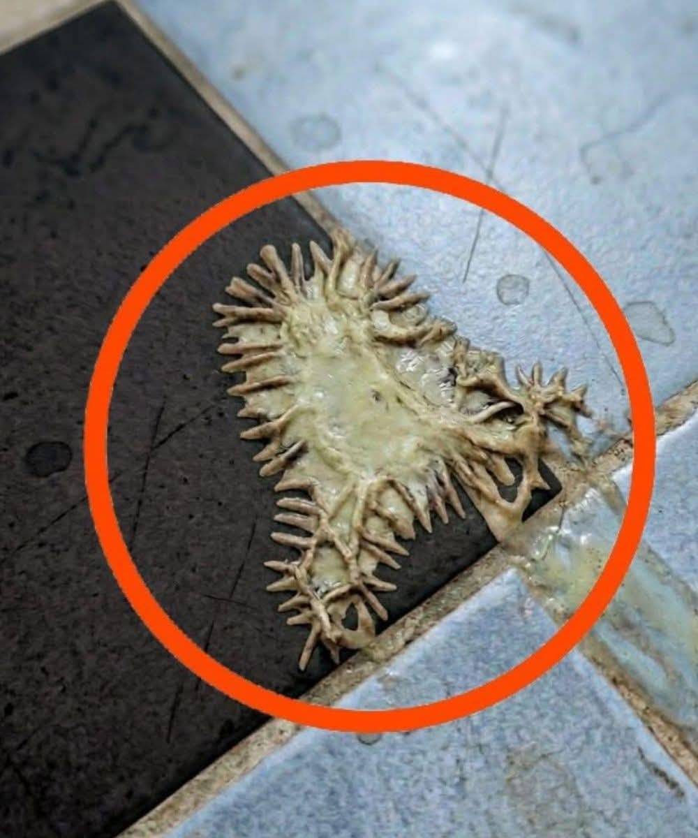 wSkutki uboczne atorwastatyny: Musisz wiedzieć o typowych reakcjach, które sobie z nimi radzą