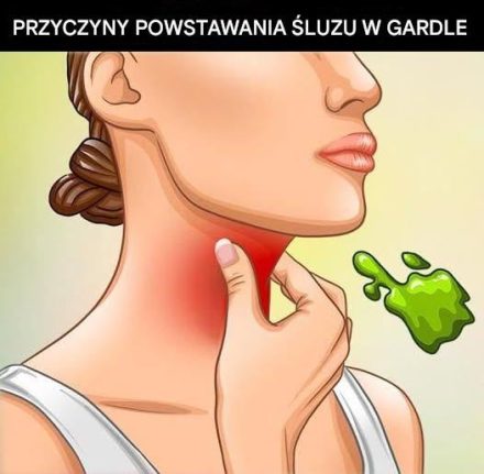 Najczęstszą, a jednak często niezdiagnozowaną, przyczyną nadmiaru śluzu jest refluks żołądkowy. Występuje on, gdy zastawka w górnej części żołądka nie zamyka się prawidłowo, co umożliwia cofanie się kwasu żołądkowego do przełyku i gardła. Chociaż kwas ten jest niezbędny do trawienia, uszkadza tkanki, gdy dociera do obszarów takich jak gardło czy zatoki, powodując stan zapalny. Aby się bronić, organizm produkuje śluz, który chroni te uszkodzone obszary. Refluksowi może towarzyszyć zgaga, ale w wielu przypadkach pojawiają się jedynie objawy związane ze śluzem – stan ten nazywany jest cichym refluksem lub chorobą refluksową przełyku (GERD).