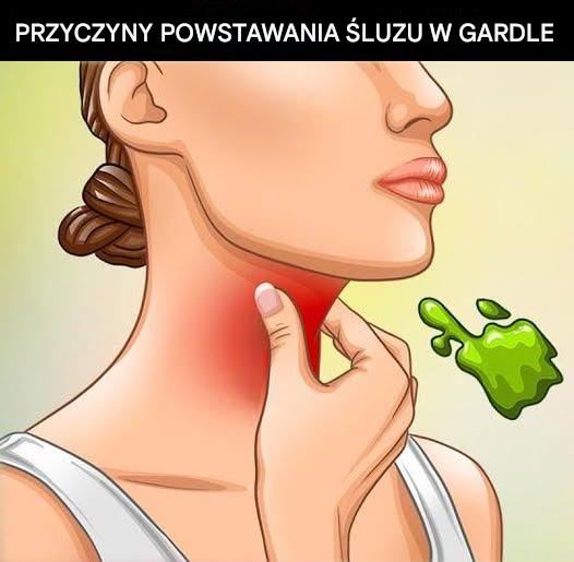 Najczęstszą, a jednak często niezdiagnozowaną, przyczyną nadmiaru śluzu jest refluks żołądkowy. Występuje on, gdy zastawka w górnej części żołądka nie zamyka się prawidłowo, co umożliwia cofanie się kwasu żołądkowego do przełyku i gardła. Chociaż kwas ten jest niezbędny do trawienia, uszkadza tkanki, gdy dociera do obszarów takich jak gardło czy zatoki, powodując stan zapalny. Aby się bronić, organizm produkuje śluz, który chroni te uszkodzone obszary. Refluksowi może towarzyszyć zgaga, ale w wielu przypadkach pojawiają się jedynie objawy związane ze śluzem – stan ten nazywany jest cichym refluksem lub chorobą refluksową przełyku (GERD).