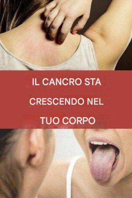 19 segnali d'allarme che indicano la presenza di un tumore nel tuo corpo Articolo completo 👇 💬