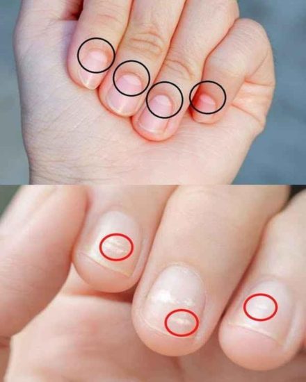 Una mezzaluna sulle unghie indica la tua salute