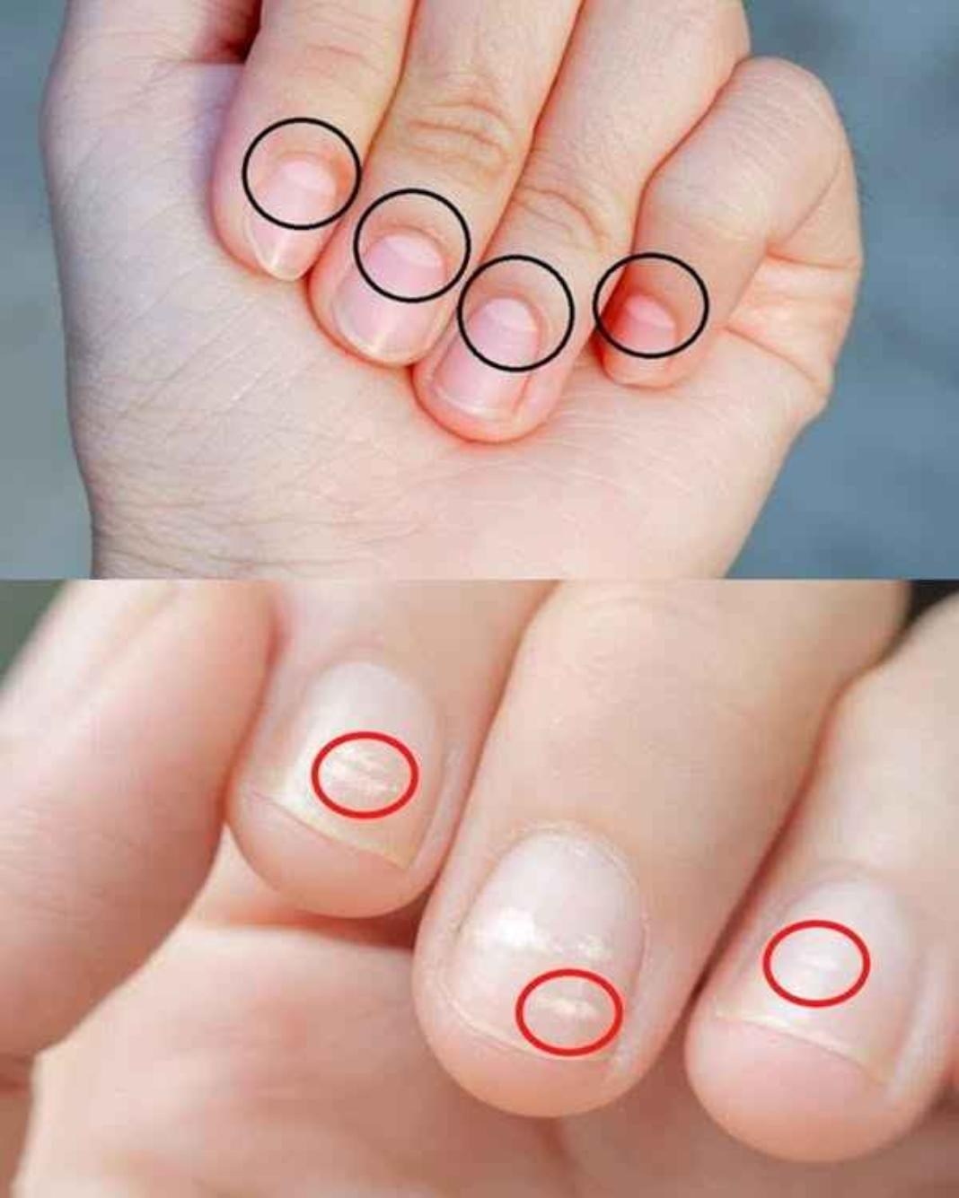 Una mezzaluna sulle unghie indica la tua salute