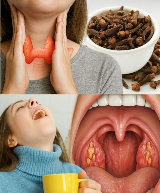 🌿 Chiodi di garofano: l'antibiotico naturale che combatte rapidamente mal di gola e infiammazione Scopri di più: