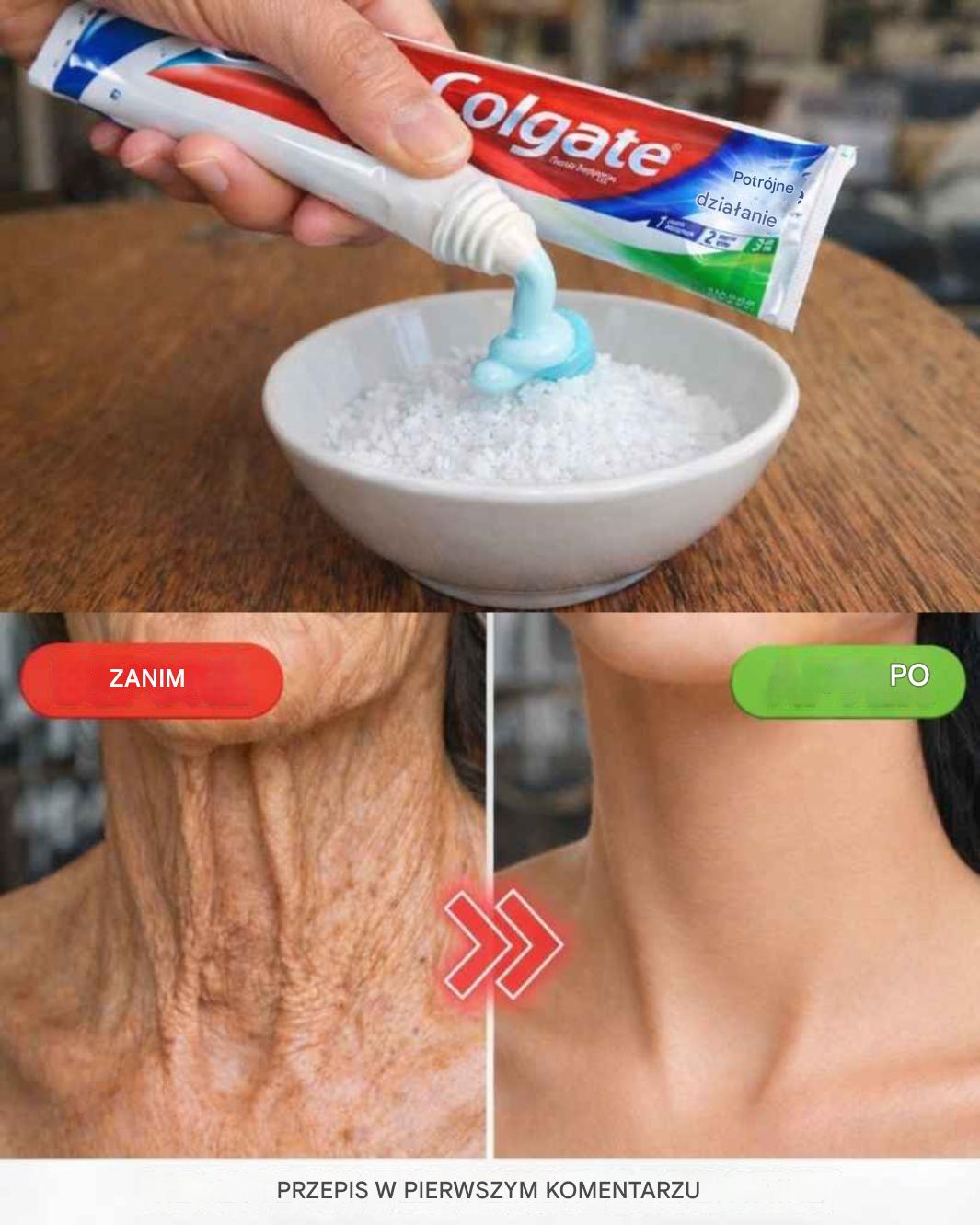 „Ludzie myślą, że jestem chirurgiem plastycznym!” – Naturalna metoda wygładzania zmarszczek i przebarwień na dłoniach i ramionach (Prosty przepis w środku)